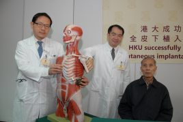 Professor Tse Hung-fat (Left), William M W Mong Professor in Cardiology, Chair Professor of Department of Medicine and Dr David Siu Chung-wah (Middle), Clinical Associate Professor of Department of Medicine, Li Ka Shing Faculty of Medicine, HKU successfully performs a surgery for Mr Yeung (Right) to install a subcutaneous implantable cardioverter defibrillator to prevent sudden cardiac arrest.